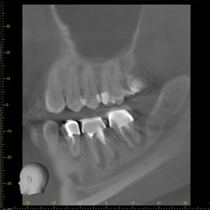 Imagerie 3D Dr Cyrille Noirault